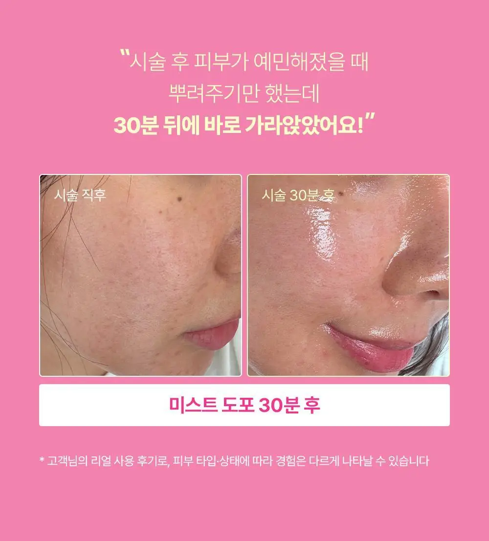 [수분장벽/진정잠금] 런드리유 카밍 고체미스트 100g+30g 기획 상세페이지 2
